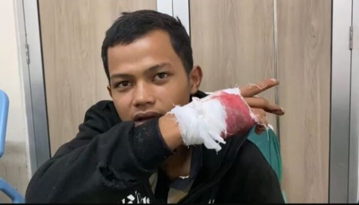 Empat Pemuda di Cibadak Sukabumi Dibacok Gerombolan Bermotor