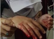 Wadah MBG Diduga Tajam, Siswa di Sukaraja Sukabumi Terluka